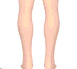 W&W Mode | Orthopädische Schuhe Für Damen